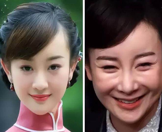 有人长出老年斑有人家破人亡毁了脸qy千亿国际6位过气明星现状：(图12)